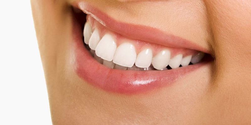 Teeth Whitening